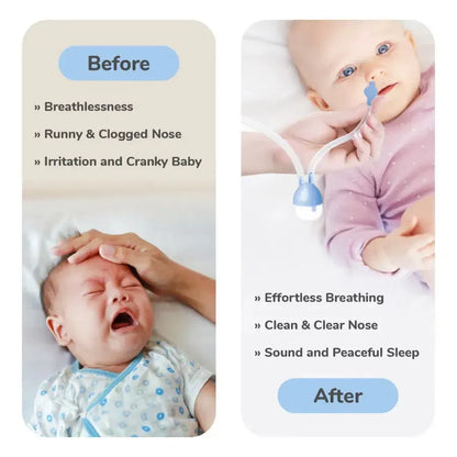 Snowy Nasal Cleaner For Baby Painless Relief from Mucus and Blocked Nose - Blue