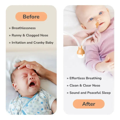 Snowy Nasal Cleaner For Baby Painless Relief from Mucus and Blocked Nose - Orange